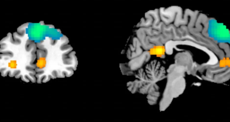 Studimi i trurit nga AI, shpresë për të mbijetuarit e traumave të fëmijërisë